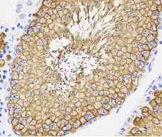 Animal Testicular Tissue Fixative Solution1 Animal Testicular Tissue Fixative Solution1