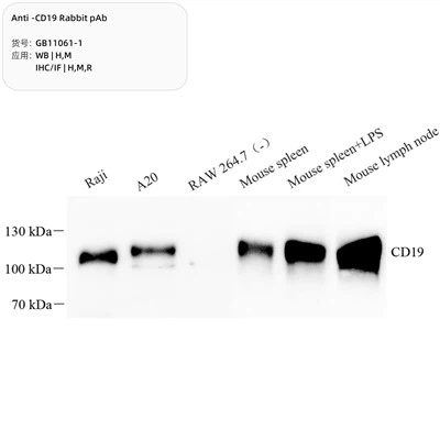 অ্যান্টি-সিডি 199 খরগোশের পিএবি