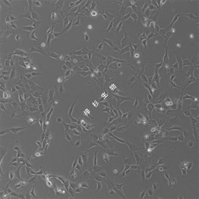 SV40T ট্রান্সফেক্টেড হিউম্যান এমবিলিকাল ভেইন এন্ডোথেলিয়াল সেল (PUMC-HUVEC-T1) কালচার মিডিয়াম কিট